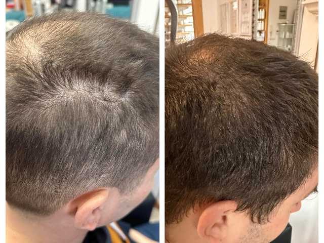 Hajgyógyászat Hajgyógyászat